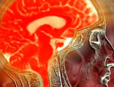 Η ανεργία αυξάνει τον κίνδυνο εγκεφαλικού